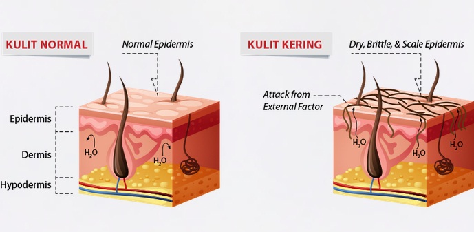 Kulit kering atasi dengan Krim Black Jam original Raw