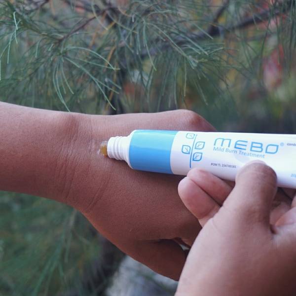 Salep Mebo untuk Luka Bakar