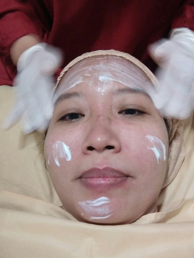 krim phyto untuk mencegah bruntus komedo