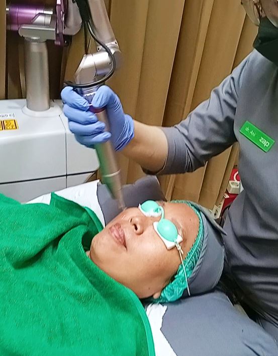 Face Toning ZAP